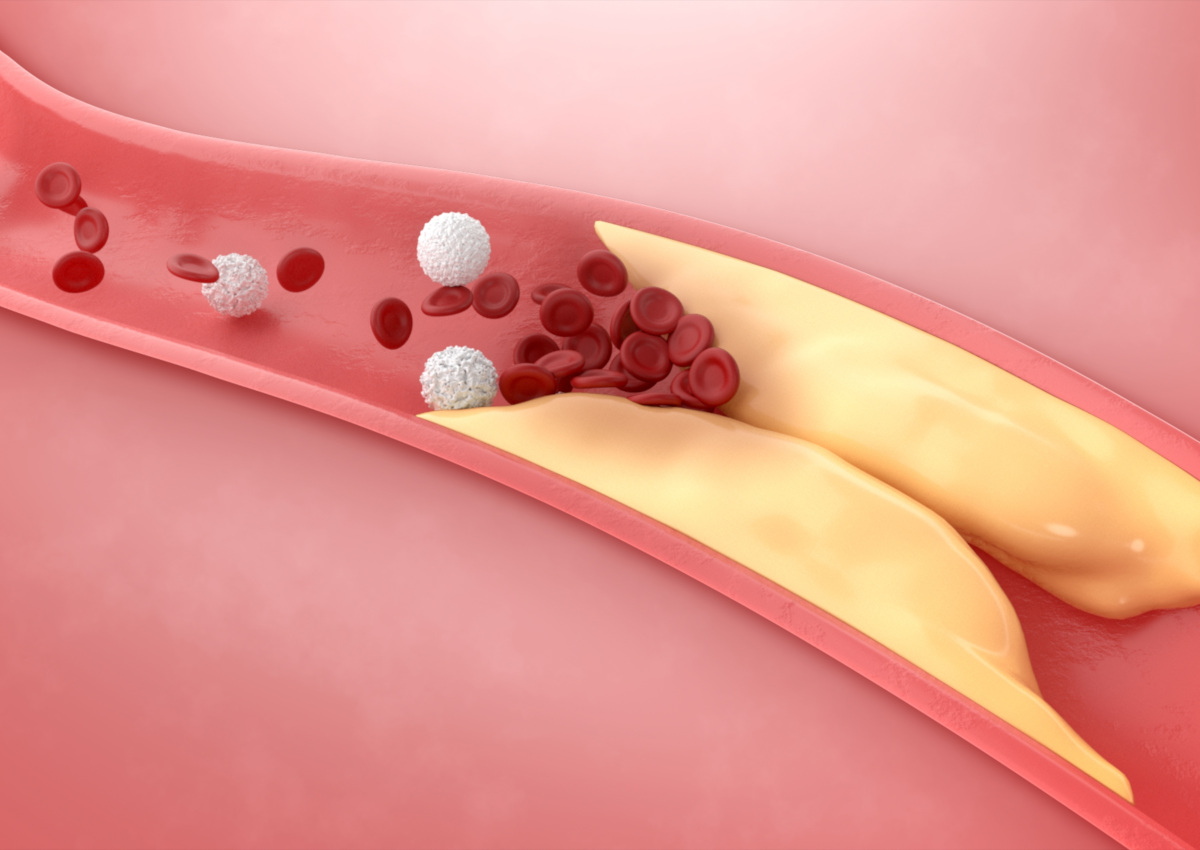 pollenza-scalo-profilo-lipidico